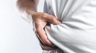 Obesidad: qué es, síntomas y soluciones
